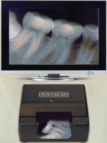 Как отсканировать рентгеновский снимок на обычном сканере