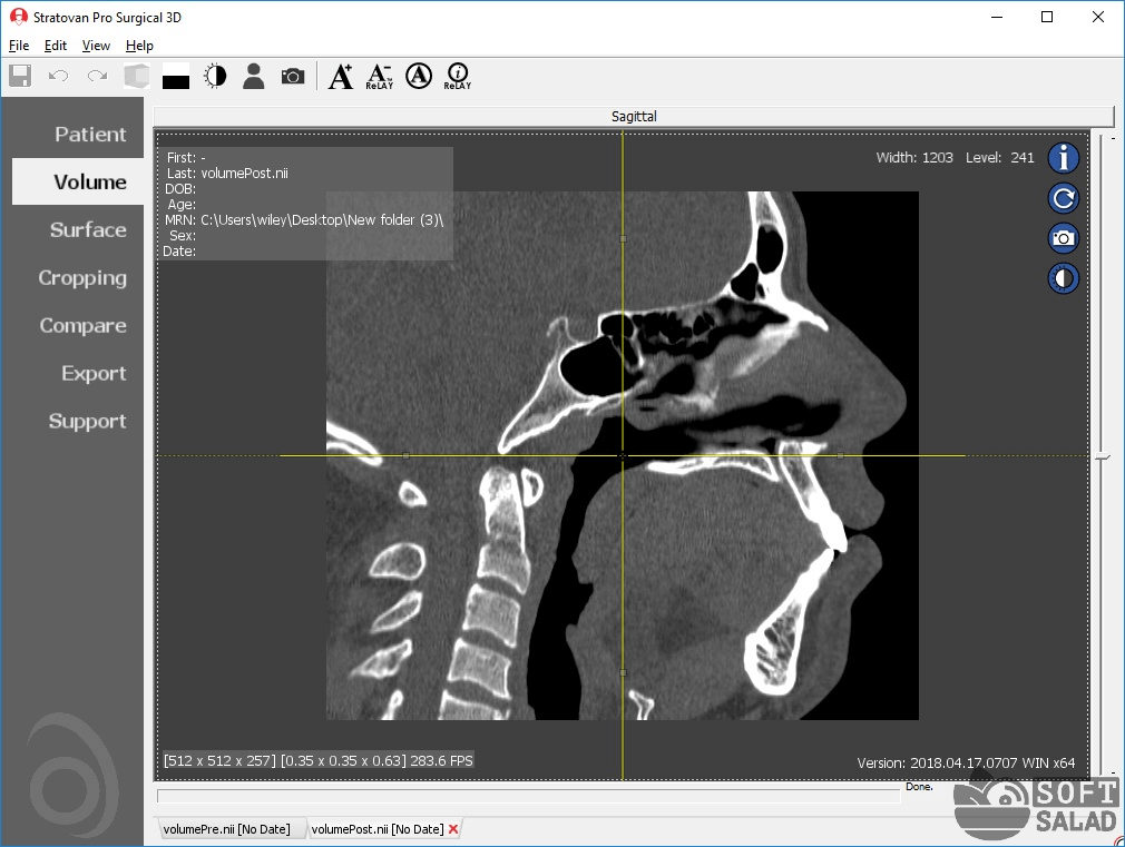 Как отсканировать рентгеновский снимок: можно ли на сканере?