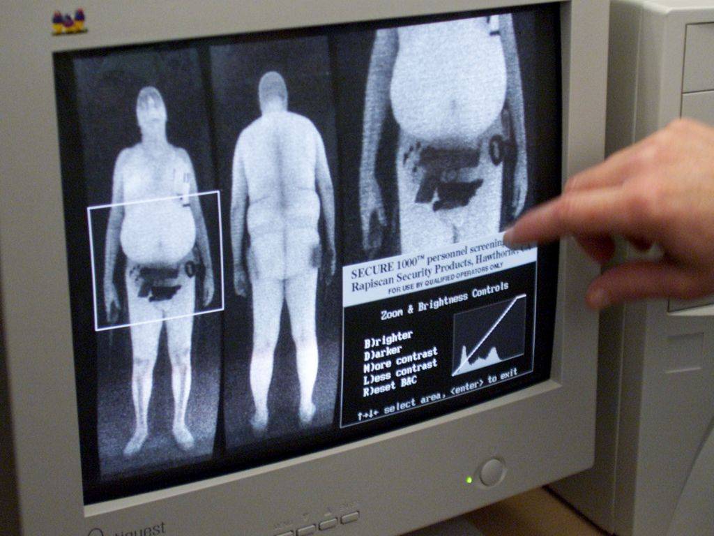 Как отсканировать рентгеновский снимок: можно ли на сканере?