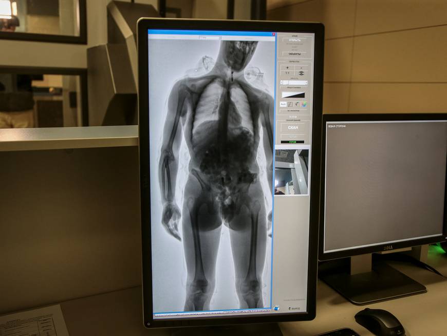 Можно ли сканировать рентгеновские снимки – как отсканировать рентгеновский снимок на обычном сканере: инструкция