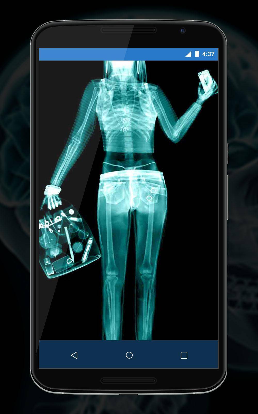 Несколько советов как отсканировать рентгеновский снимок